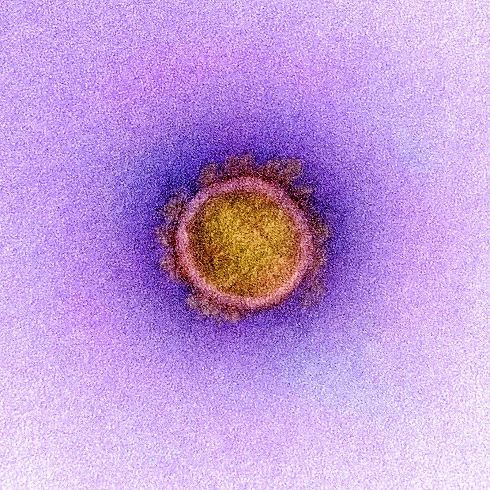 Image of 20200224 zaa p138 in The Year of the Virus - Cosentino